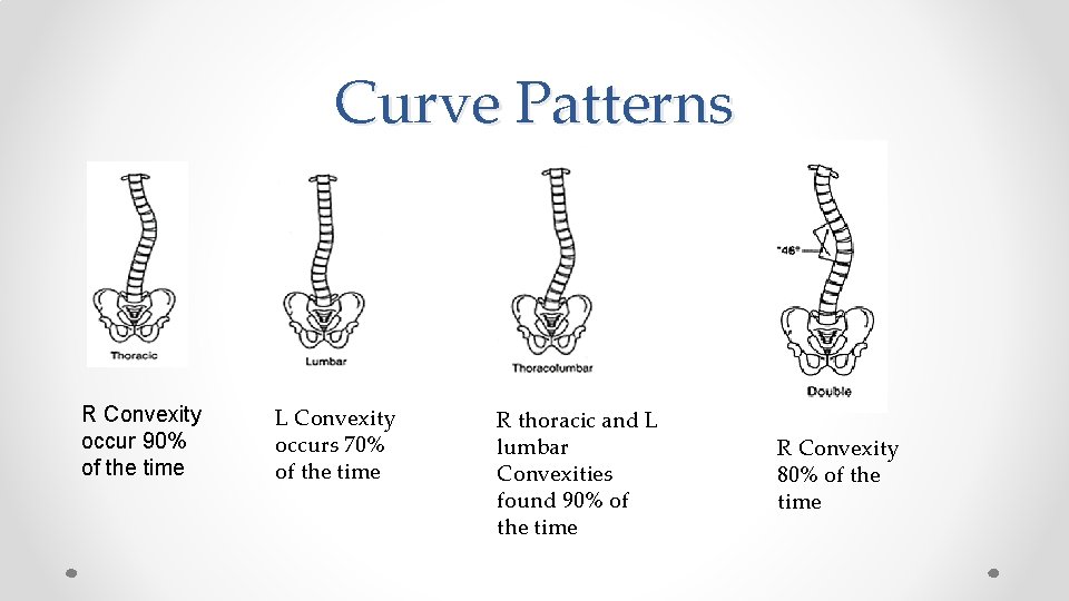 Curve Patterns R Convexity occur 90% of the time L Convexity occurs 70% of