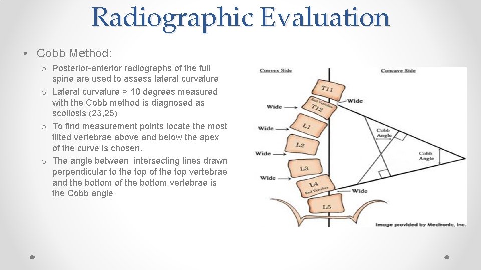 Radiographic Evaluation • Cobb Method: o Posterior-anterior radiographs of the full spine are used