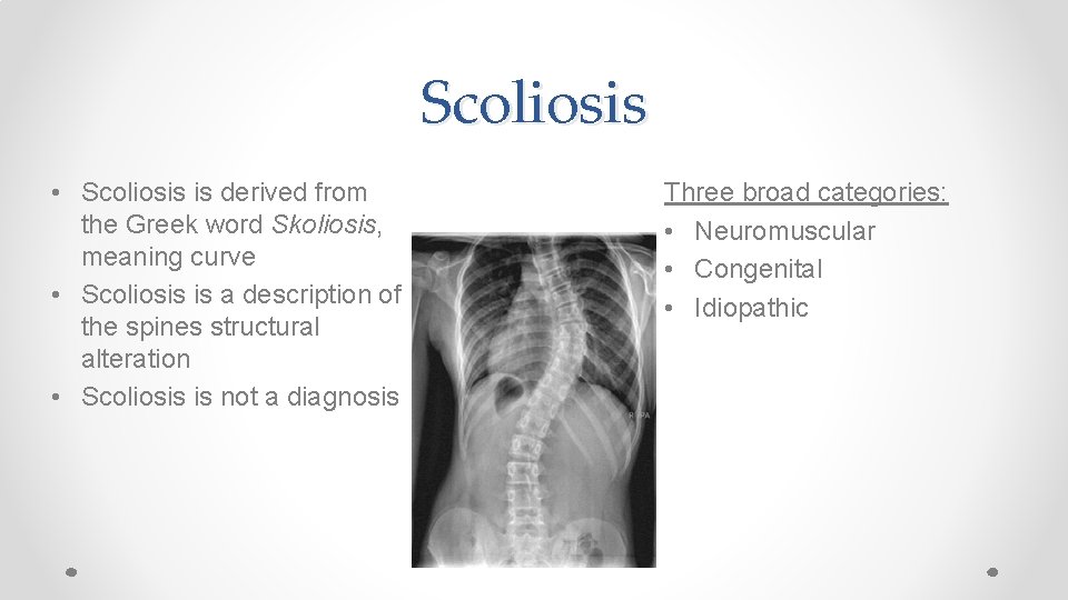 Scoliosis • Scoliosis is derived from the Greek word Skoliosis, meaning curve • Scoliosis