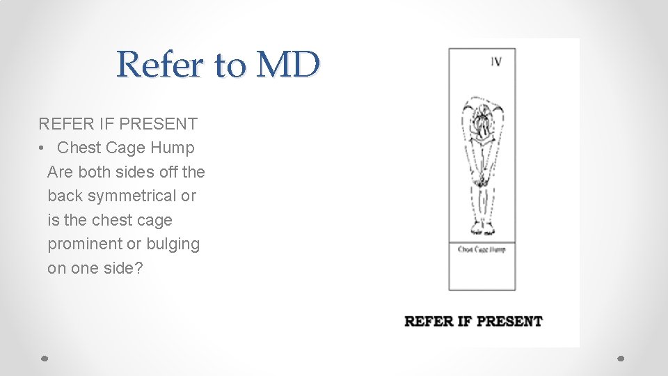 Refer to MD REFER IF PRESENT • Chest Cage Hump Are both sides off