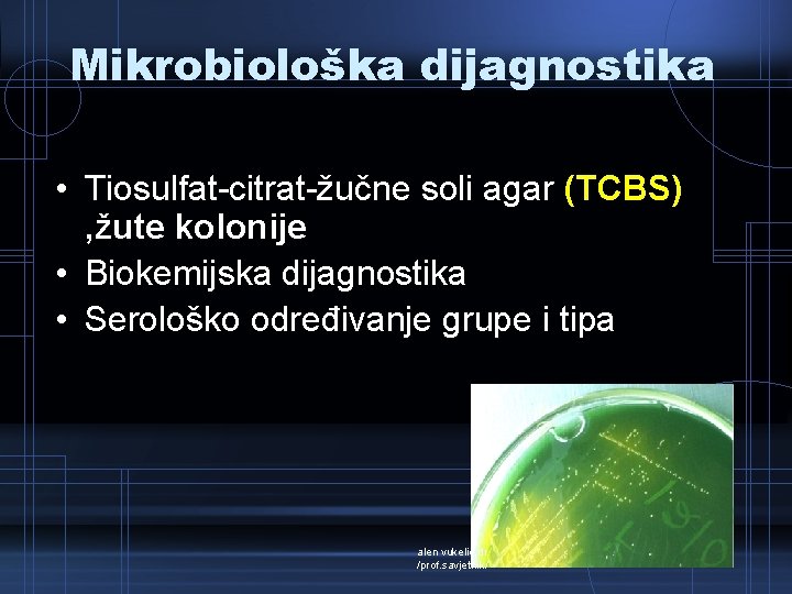 Mikrobiološka dijagnostika • Tiosulfat-citrat-žučne soli agar (TCBS) , žute kolonije • Biokemijska dijagnostika •