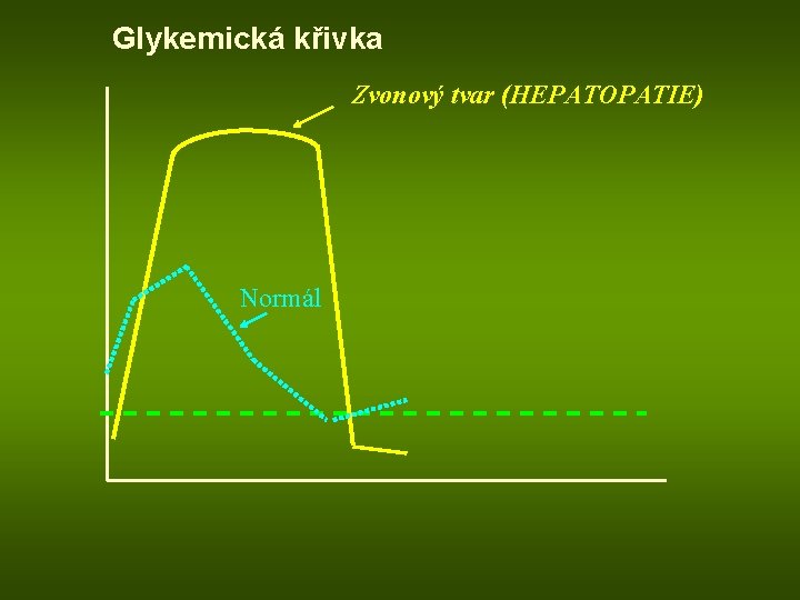 Glykemická křivka Zvonový tvar (HEPATOPATIE) Normál 