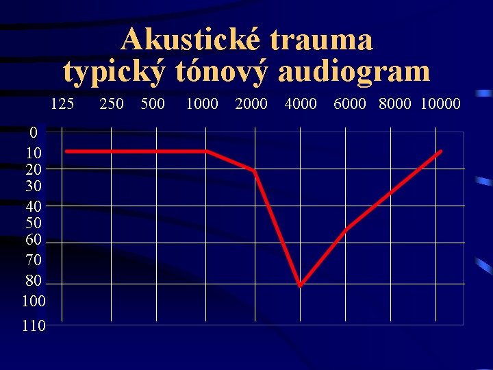 Akustické trauma typický tónový audiogram 125 0 10 20 30 40 50 60 70