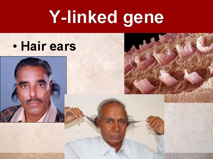 Y-inheritance Y-linked gene • Hair ears 