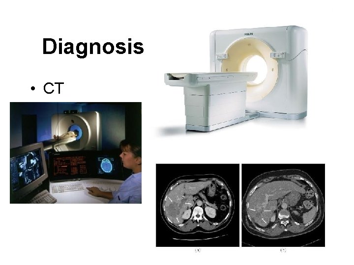 Diagnosis • CT 