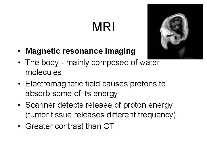 MRI • Magnetic resonance imaging • The body - mainly composed of water molecules