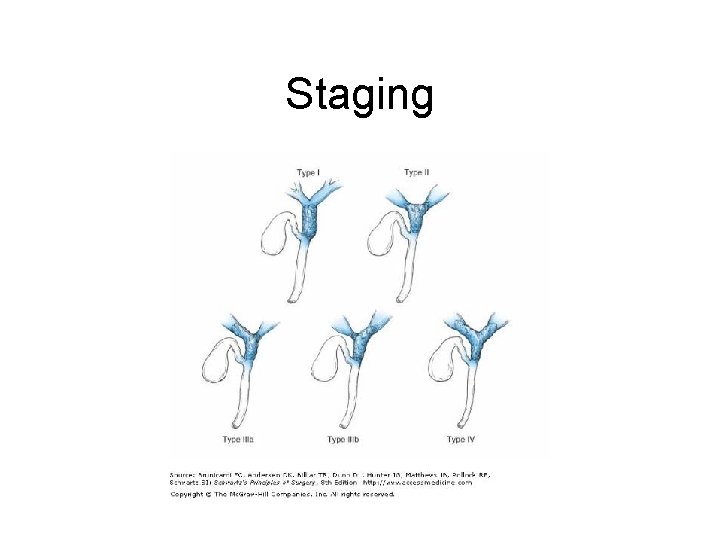 Staging 