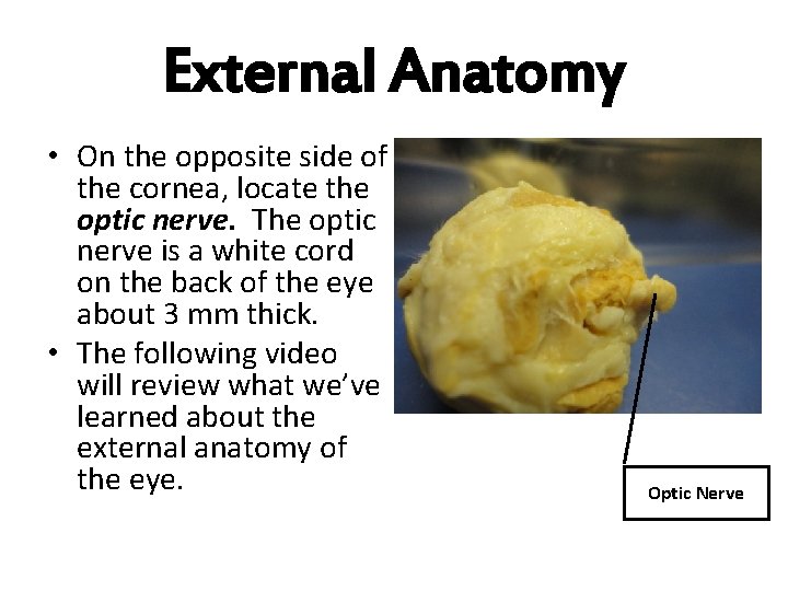 External Anatomy • On the opposite side of the cornea, locate the optic nerve.