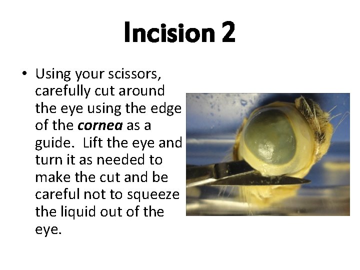 Incision 2 • Using your scissors, carefully cut around the eye using the edge