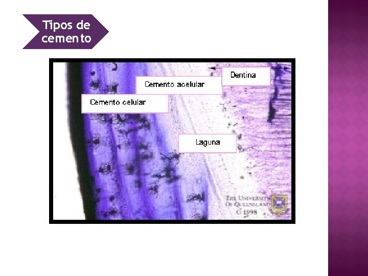 Tipos de cemento 