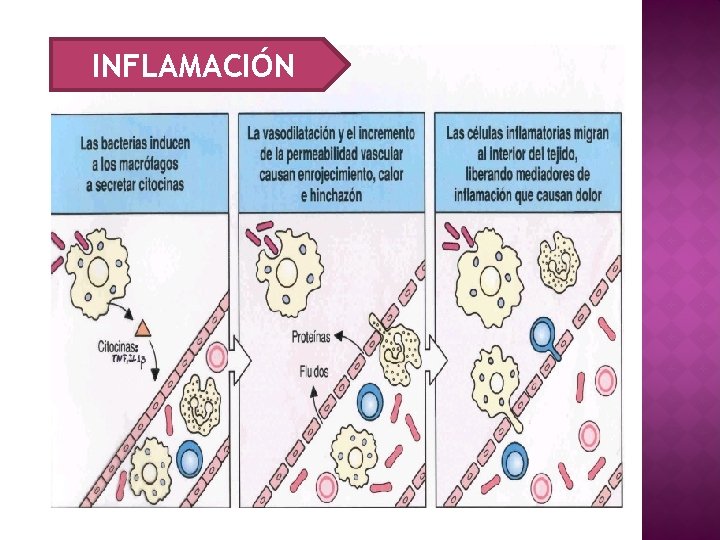 INFLAMACIÓN 