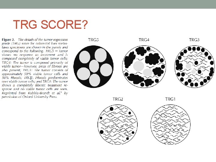TRG SCORE? 