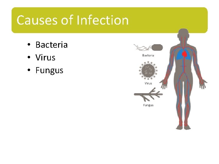 Causes of Infection • Bacteria • Virus • Fungus 