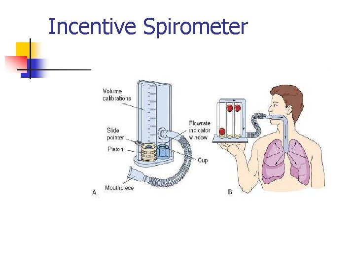 Incentive Spirometer 