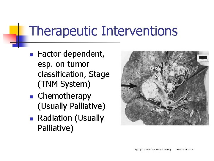 Therapeutic Interventions n n n Factor dependent, esp. on tumor classification, Stage (TNM System)