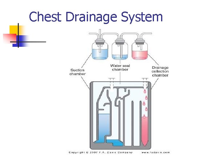 Chest Drainage System 