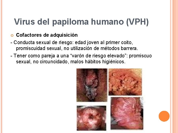 Virus del papiloma humano (VPH) Cofactores de adquisición - Conducta sexual de riesgo: edad