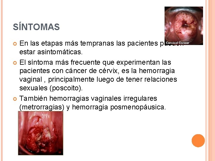 SÍNTOMAS En las etapas más tempranas las pacientes pueden estar asintomáticas. El síntoma más