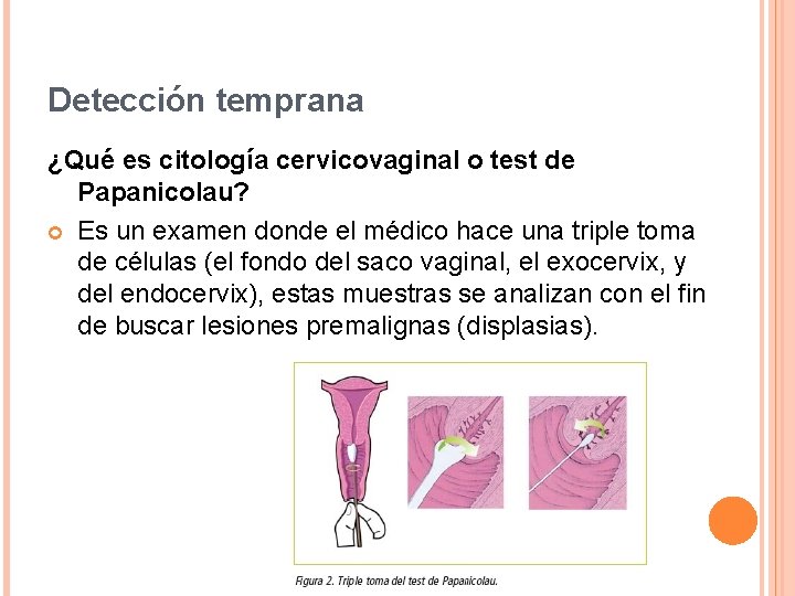 Detección temprana ¿Qué es citología cervicovaginal o test de Papanicolau? Es un examen donde