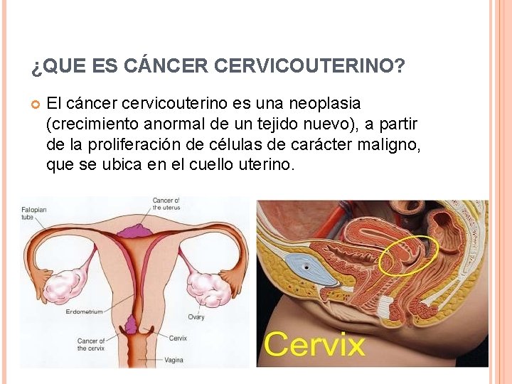 ¿QUE ES CÁNCER CERVICOUTERINO? El cáncer cervicouterino es una neoplasia (crecimiento anormal de un