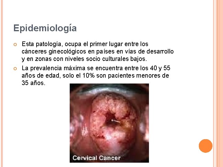 Epidemiología Esta patología, ocupa el primer lugar entre los cánceres ginecológicos en países en