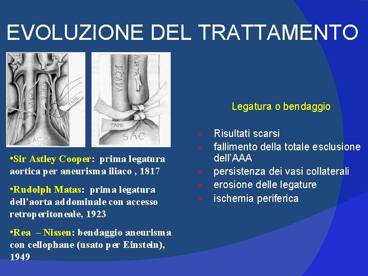 EVOLUZIONE DEL TRATTAMENTO Legatura o bendaggio § § • Sir Astley Cooper: prima legatura