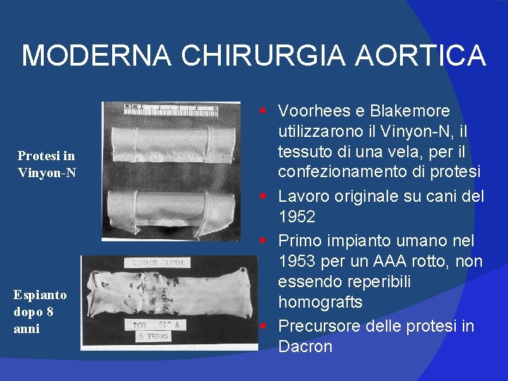 MODERNA CHIRURGIA AORTICA Protesi in Vinyon-N Espianto dopo 8 anni § Voorhees e Blakemore MODERNA CHIRURGIA AORTICA Protesi in Vinyon-N Espianto dopo 8 anni § Voorhees e Blakemore
