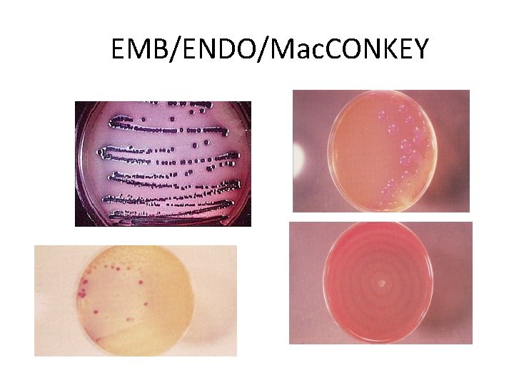 EMB/ENDO/Mac. CONKEY 