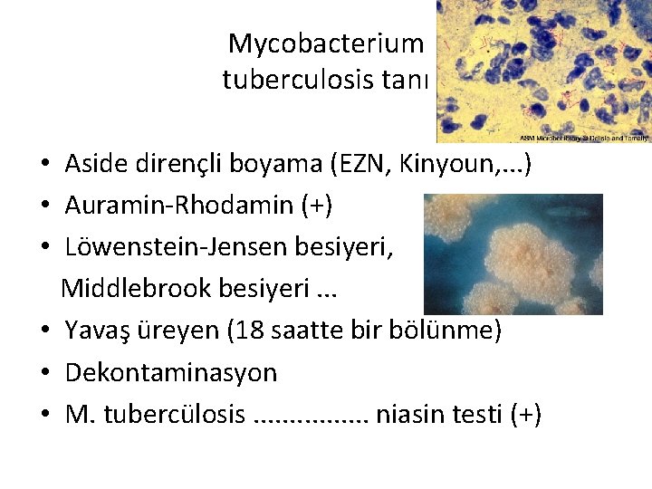 Mycobacterium tuberculosis tanı • Aside dirençli boyama (EZN, Kinyoun, . . . ) •
