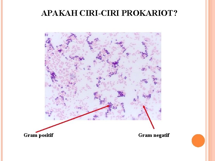 APAKAH CIRI-CIRI PROKARIOT? Gram positif Gram negatif 