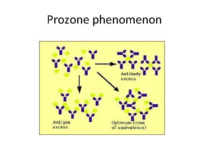 Prozone phenomenon 