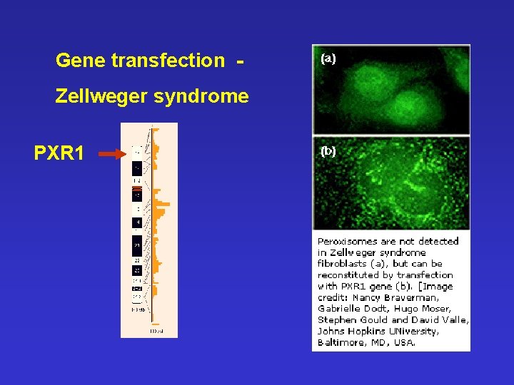 Gene transfection Zellweger syndrome PXR 1 