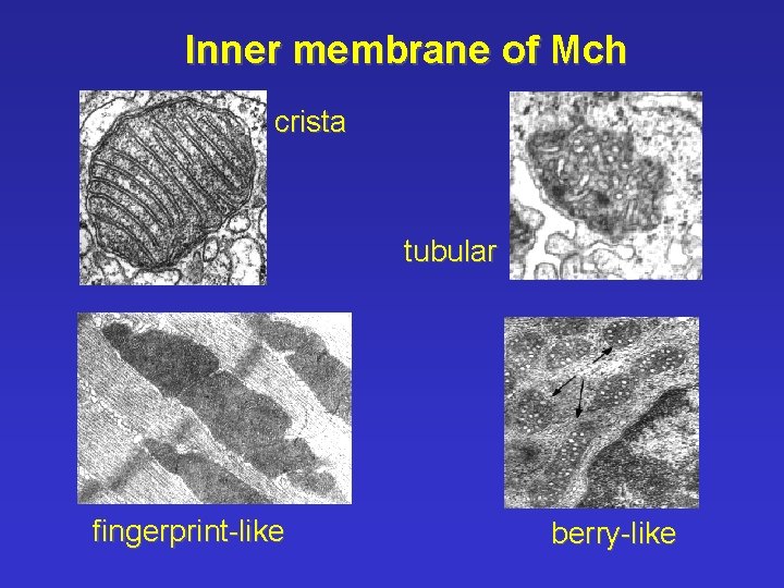 Inner membrane of Mch crista tubular fingerprint-like berry-like 