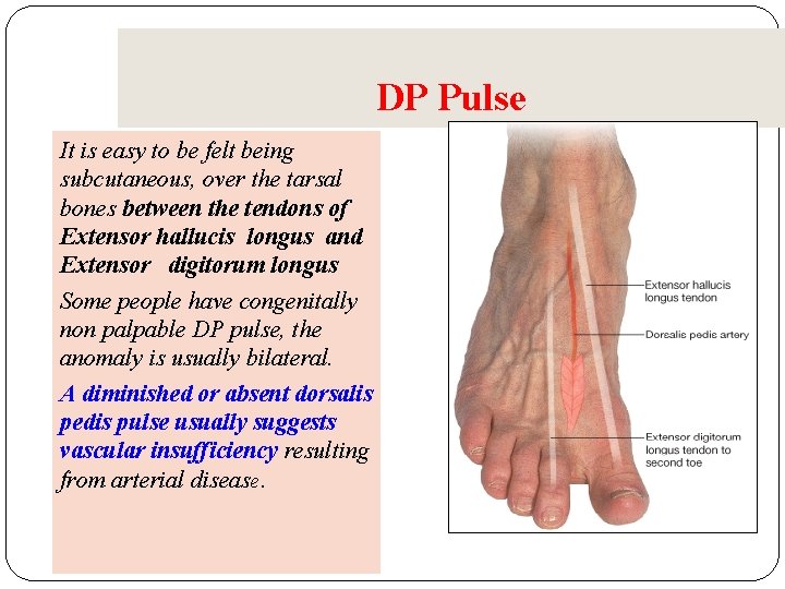 DP Pulse It is easy to be felt being subcutaneous, over the tarsal bones