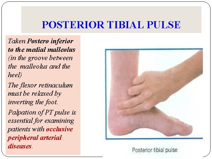 POSTERIOR TIBIAL PULSE Taken Postero inferior to the medial malleolus (in the groove between POSTERIOR TIBIAL PULSE Taken Postero inferior to the medial malleolus (in the groove between