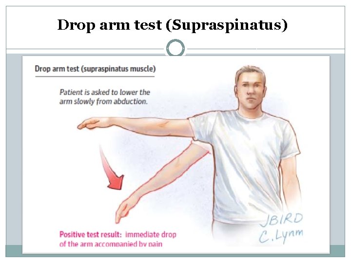 Drop arm test (Supraspinatus) 