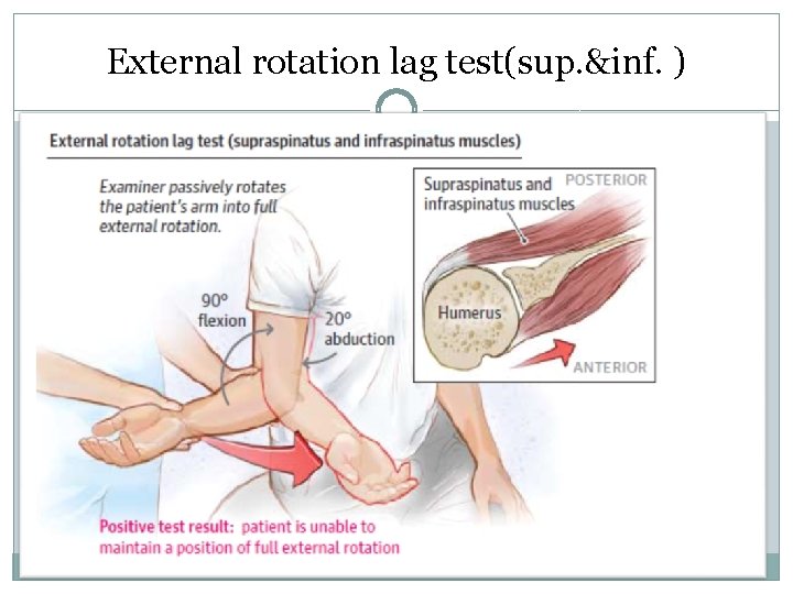 External rotation lag test(sup. &inf. ) 
