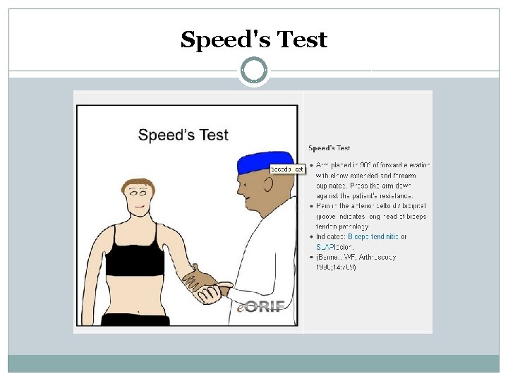 Speed's Test 