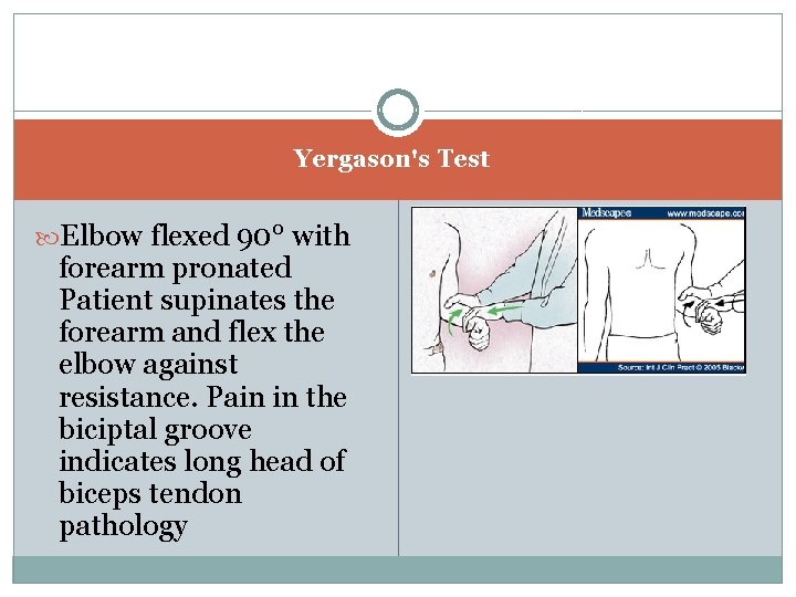 a Yergason's Test Elbow flexed 90° with forearm pronated Patient supinates the forearm and