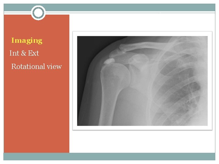 Imaging Int & Ext Rotational view 