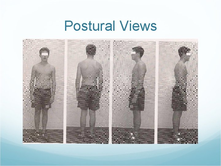 Postural Views 