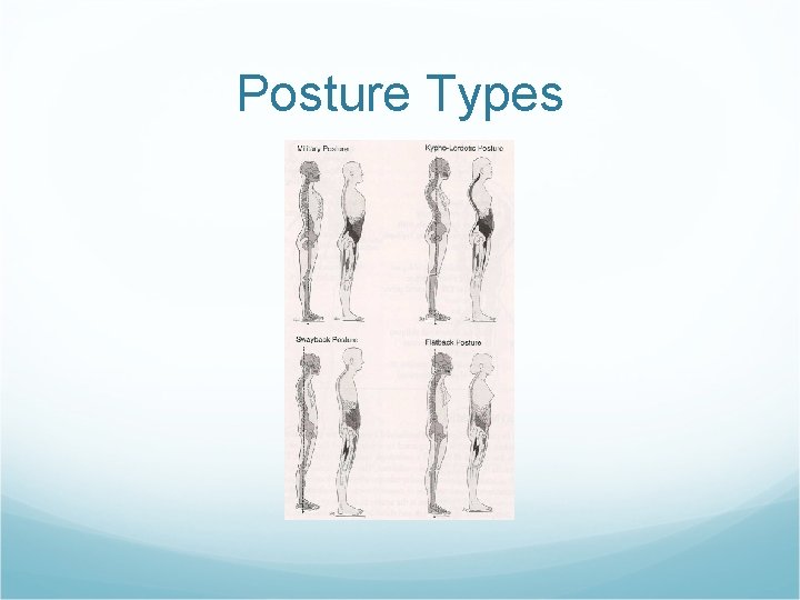 Posture Types Posture Types