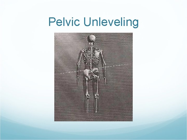 Pelvic Unleveling Pelvic Unleveling