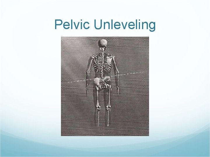 Pelvic Unleveling 