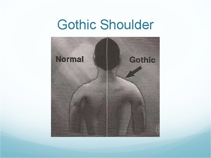 Gothic Shoulder 