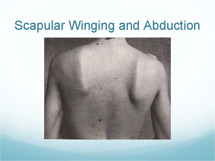 Scapular Winging and Abduction 