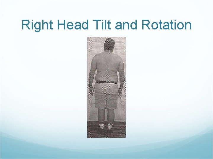 Right Head Tilt and Rotation 