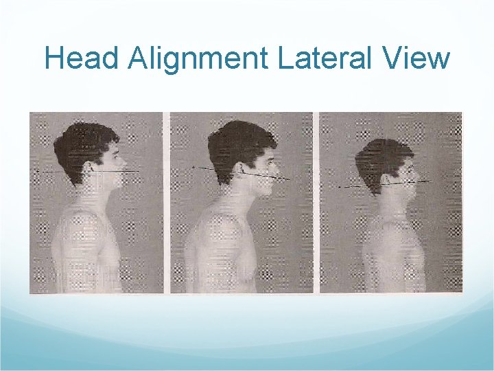 Head Alignment Lateral View 