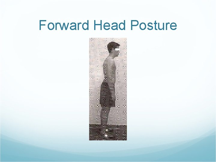 Forward Head Posture 