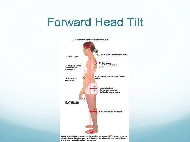 Forward Head Tilt 